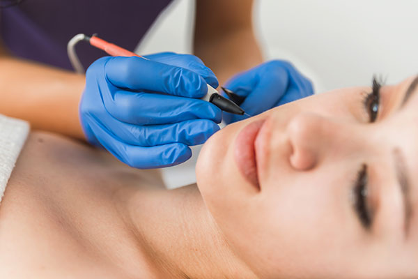 benefits of electrolysis